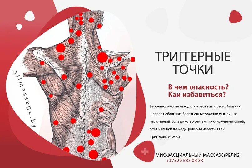 Карта триггерные точки фото Атлас триггерных точек в картинках