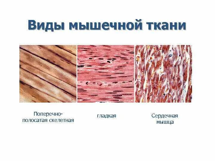 Картинка мышечной ткани животных Изображение сердечной поперечно полосатой мышечной ткани