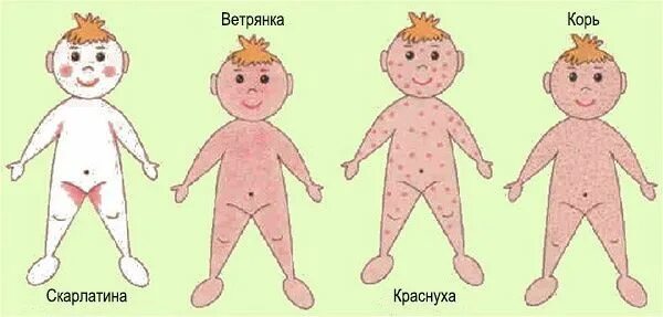 Картинка сыпь у детей фото Фото. Сыпь на коже у новорожденных при инфекционных заболеваниях. Fictional char
