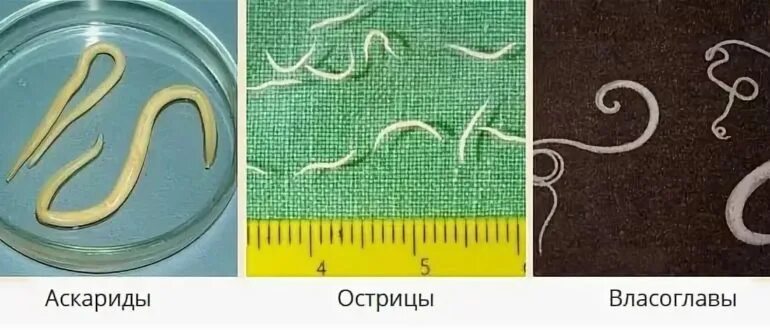 Картинки как выглядят глисты Картинки ЧЕРЕЗ СКОЛЬКО ВЫХОДЯТ ГЛИСТЫ