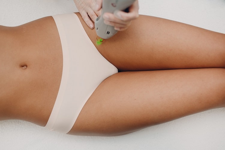 Красивые прически бикини What does full bikini laser mean, Bikini vs Brazilian laser hair removal