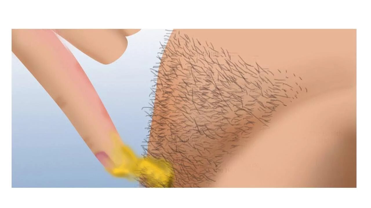 Красивые прически между ног у женщин Awesome! Here's how you can remove hair from your body (no need for waxing or sh