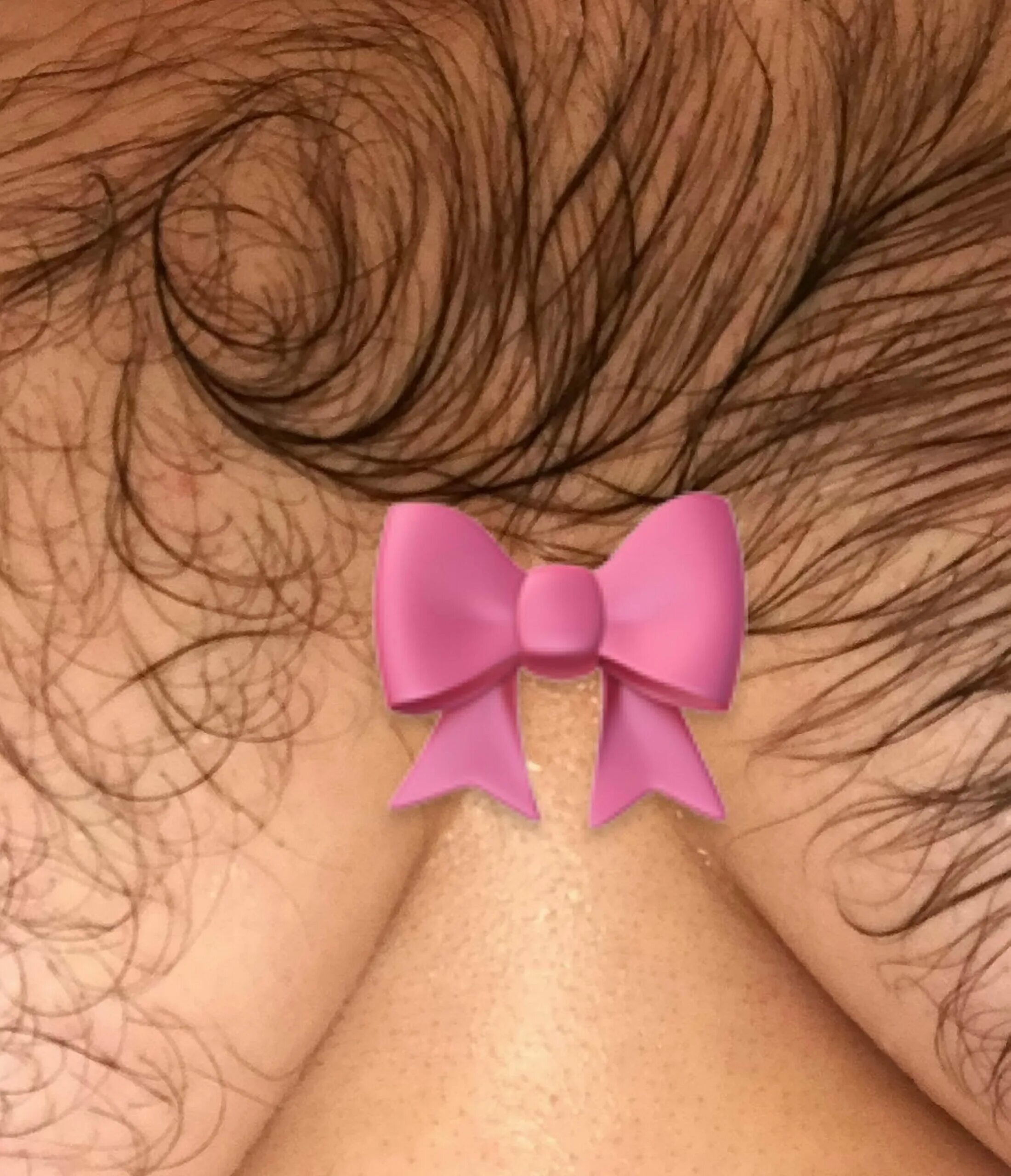 Красивые прически между ног у женщин Woman who felt like a 'freak' because of her excess body hair learns to embrace 