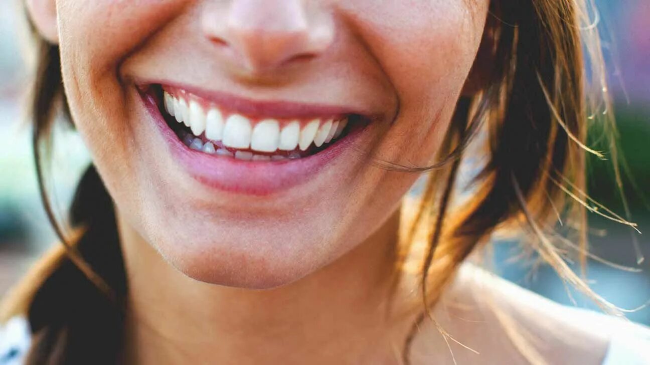Красивые улыбки и зубы фото женщин Pin on Teeth