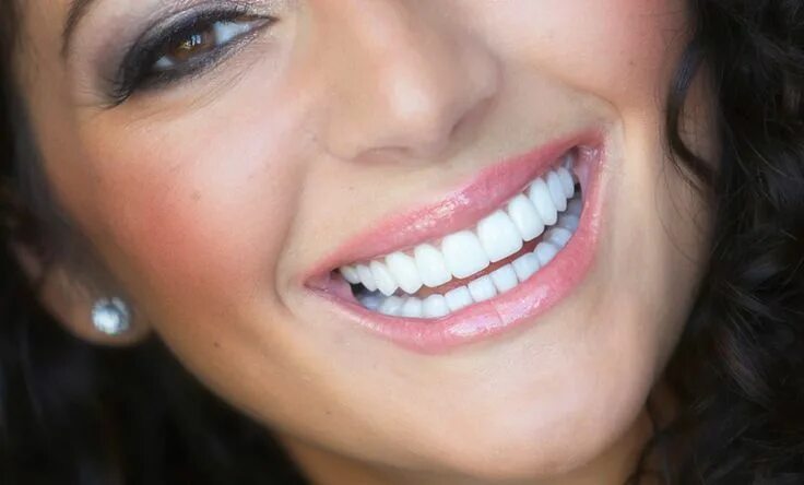 Красивые зубы фото женщины Pin en Occlusion is said to be confusing in the world.