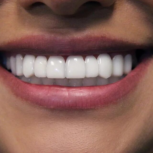 Красивые зубы фото женщины цирконий Cómo blanquear los dientes en casa - CRÉATE A TI MISMA Dientes perfectos, Dentad
