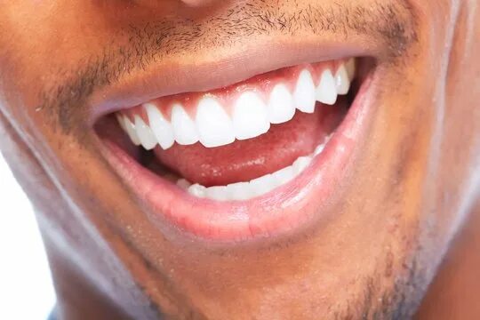 Красивые зубы ул гагарина 20 фото Teeth Smile Man Зображення - огляд 283,354 Стокові фото, векторні зображення й в