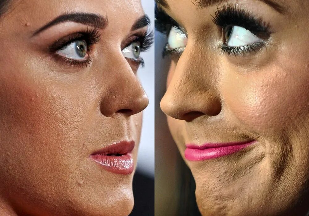 Красивый макияж без тоналки Katy Perry Brufoli, Cicatrici da acne, Problemi di salute