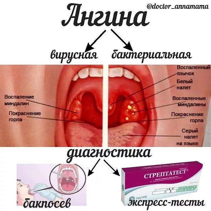 Красное горло в пятнах фото Это страшное слово "ангина" - Статьи - Клиника "C Нуля" (Здоровая семья)