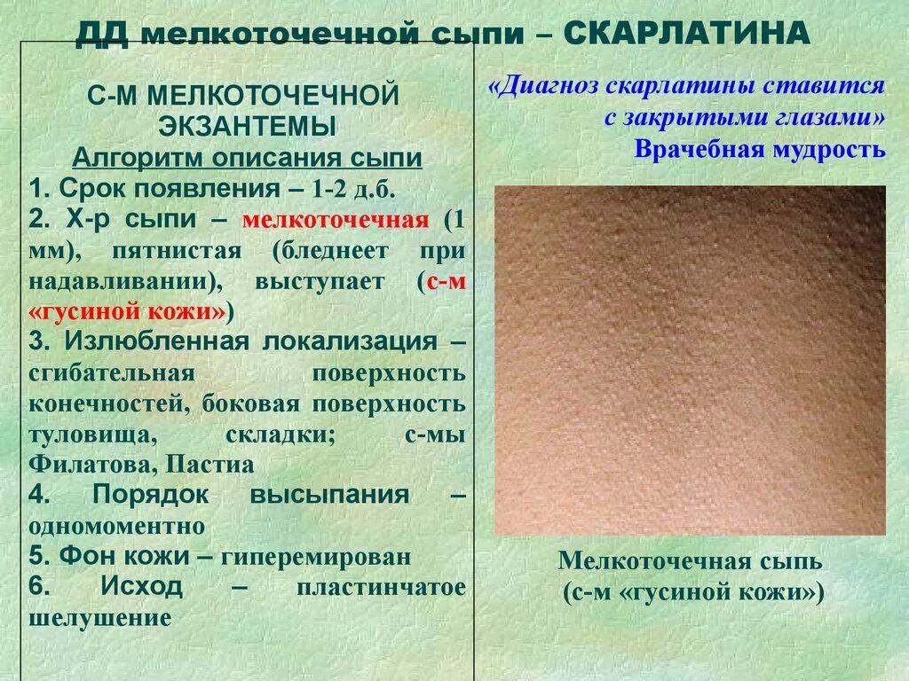 Краснуха фото сыпи у взрослых на теле Этиология сыпи