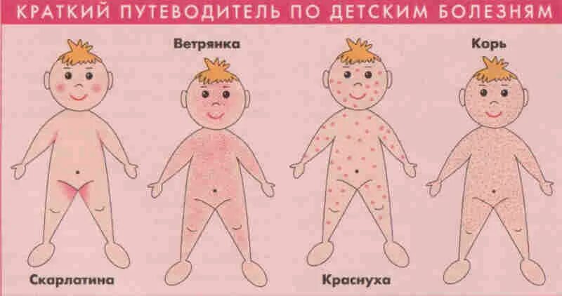 Краснуха симптомы фото сыпи Кожные заболевания у детей - что необходимо знать каждой маме
