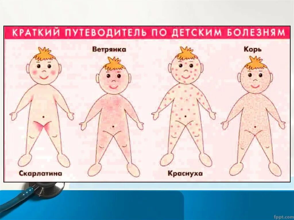 Краснуха симптомы у детей фото начальная стадия Отличие кори: найдено 86 изображений