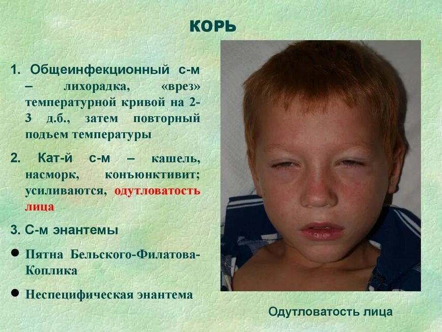 Краснуха симптомы у детей фото начальная стадия О роли вакцинации при ликвидации кори, полиомиелита, эпидемического паротита