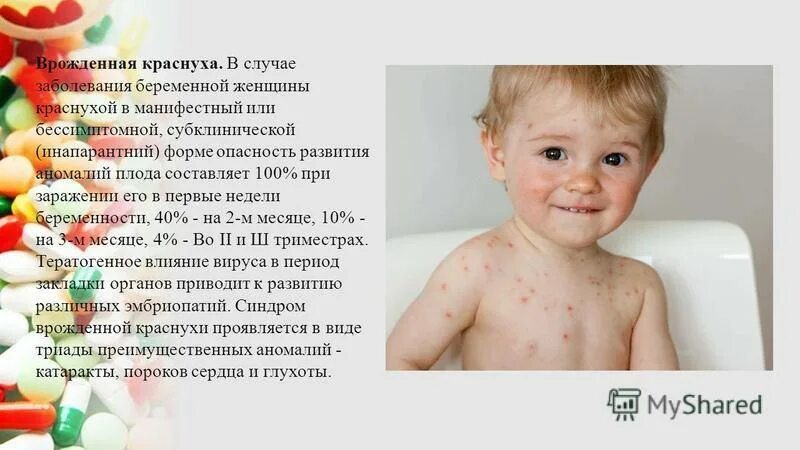 Краснуха симптомы у детей фото начальная стадия Симптомы и лечение коревой краснухи у детей: как выглядит сыпь, фото и профилакт