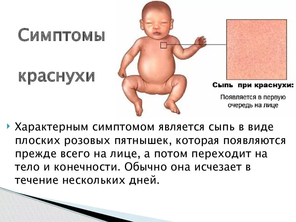 Краснуха симптомы у взрослых фото Как лечит краснуху у детей: возбудители, симптомы, инкубационный период, фото