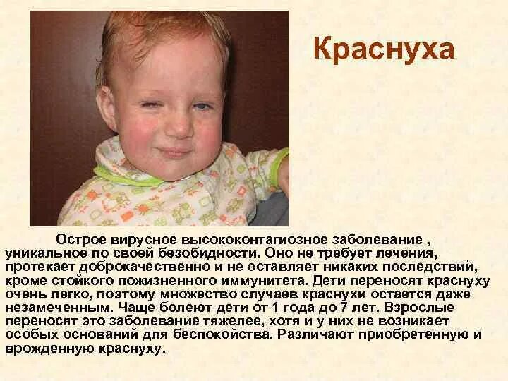Краснуха симптомы у взрослых фото Как лечить краснуху у детей