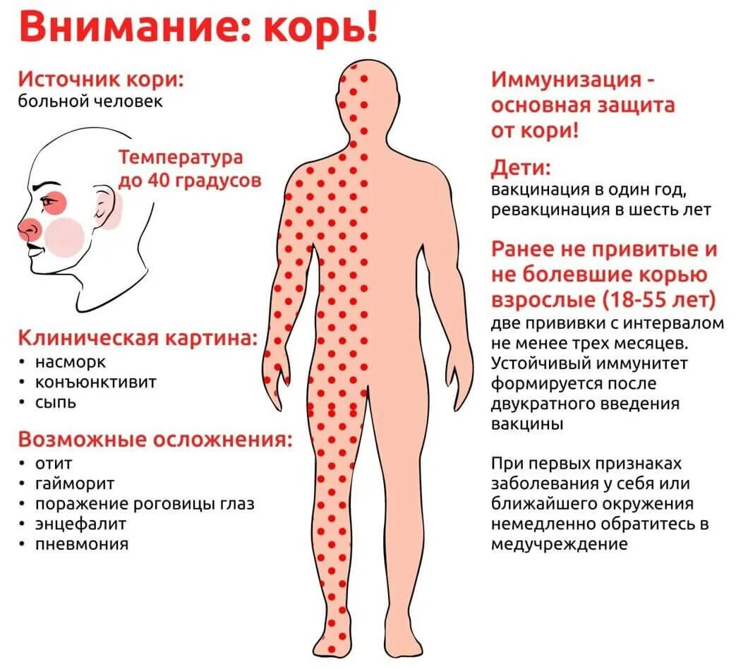 Краснуха симптомы у взрослых фото и лечение Корь: меры профилактики " Официальный портал мэрии города Черкесска