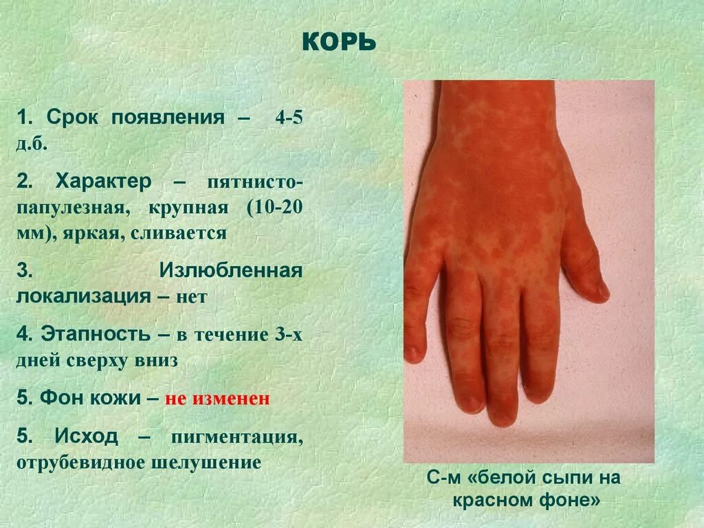 Краснуха симптомы у взрослых фото сыпи Кожные покровы умеренной влажности