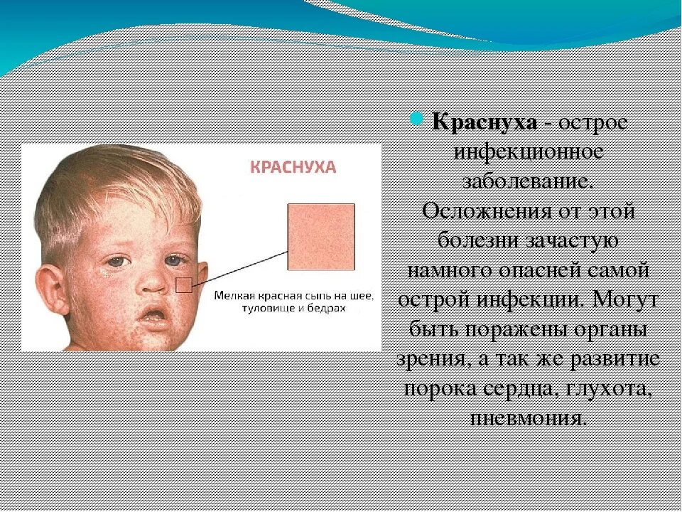 Краснуха сыпь у детей фото реальные симптомы Как лечить краснуху у детей