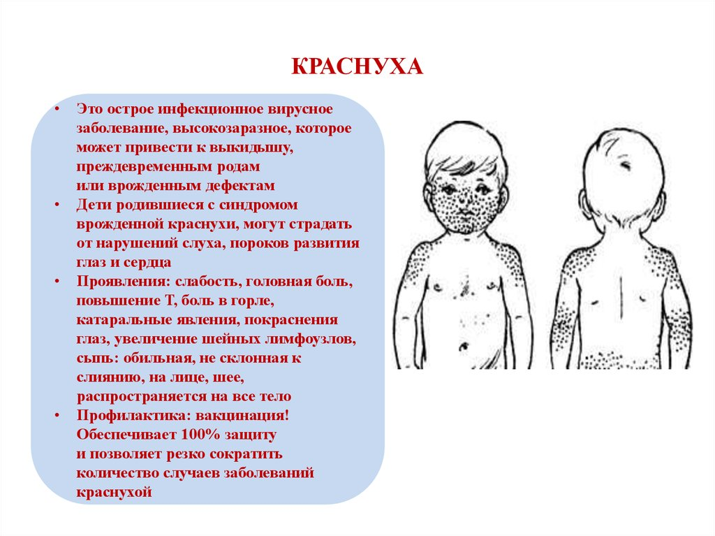 Краснуха сыпь у детей фото реальные симптомы Появляются характерные симптомы