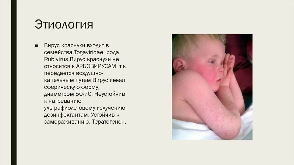 Краснуха у детей фото начальной стадии Как лечить краснуху у детей