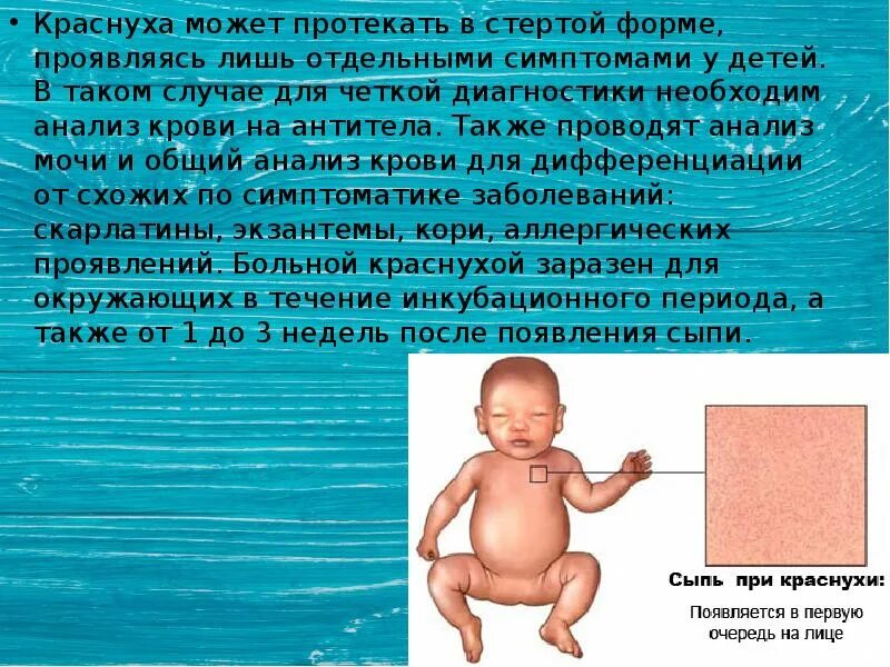 Краснуха у детей фото симптомы и лечение Краснуха у грудничка - CollectPhoto.ru
