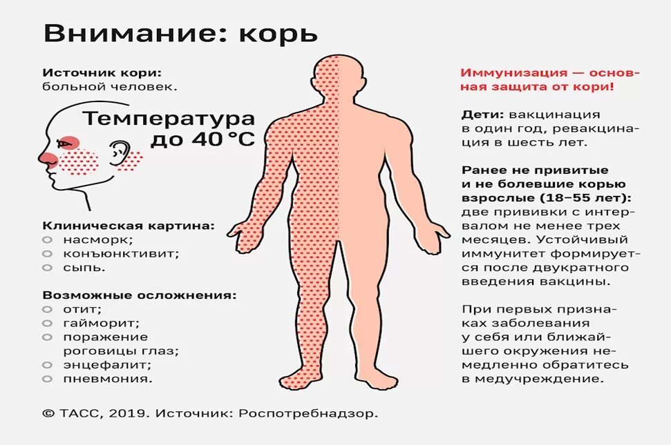 Краснуха у подростка симптомы фото сыпи Администрация Новгородского муниципального района РЕКОМЕНДАЦИИ ГРАЖДАНАМ: корь