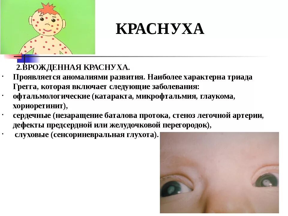Краснуха у взрослых фото сыпи лечение Как лечить краснуху у детей