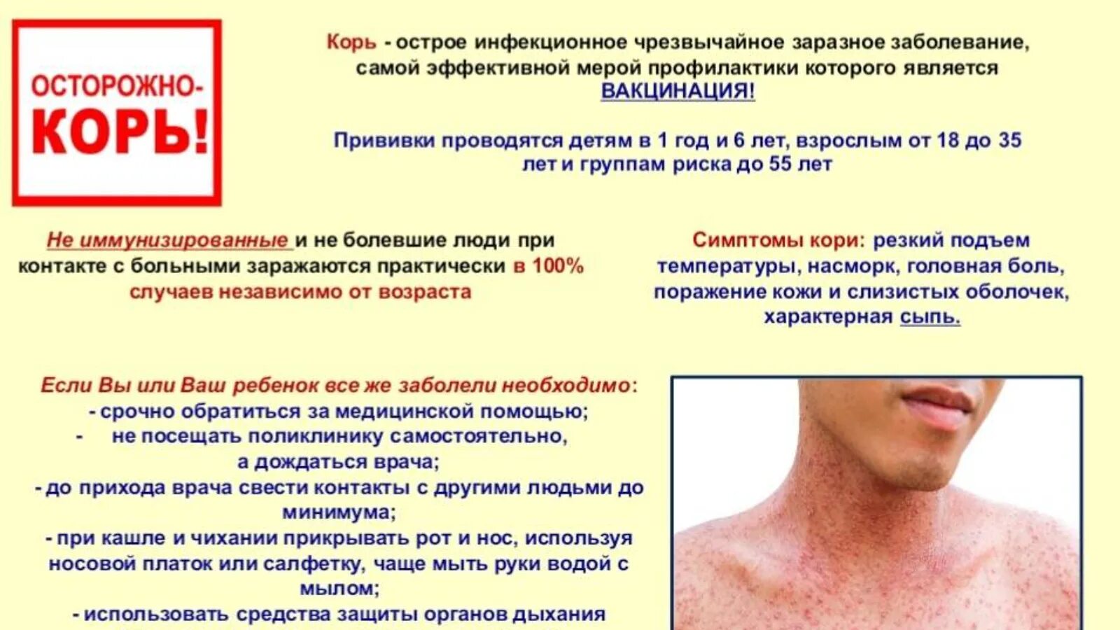 Краснуха у взрослых фото сыпи лечение ДАССУ "Кама Тамагы узэк район сырхауханэсе"