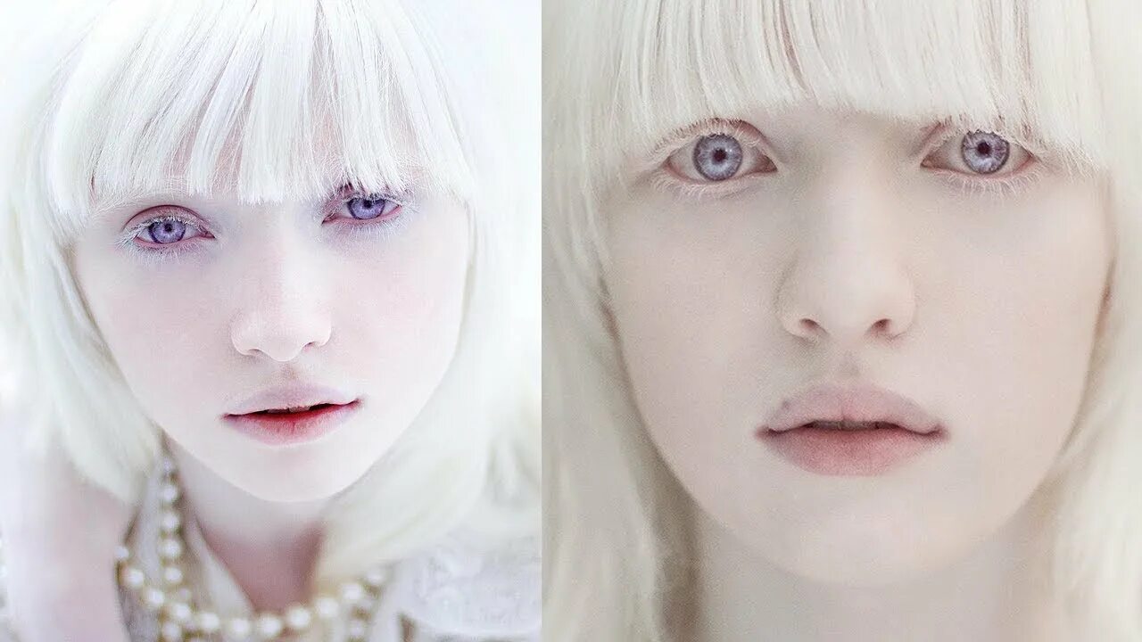 Красные глаза альбиносов фото Gadis Albino Ini Sejak Kecil Dihina, Tapi Setelah Dewasa Bak Peri! - YouTube