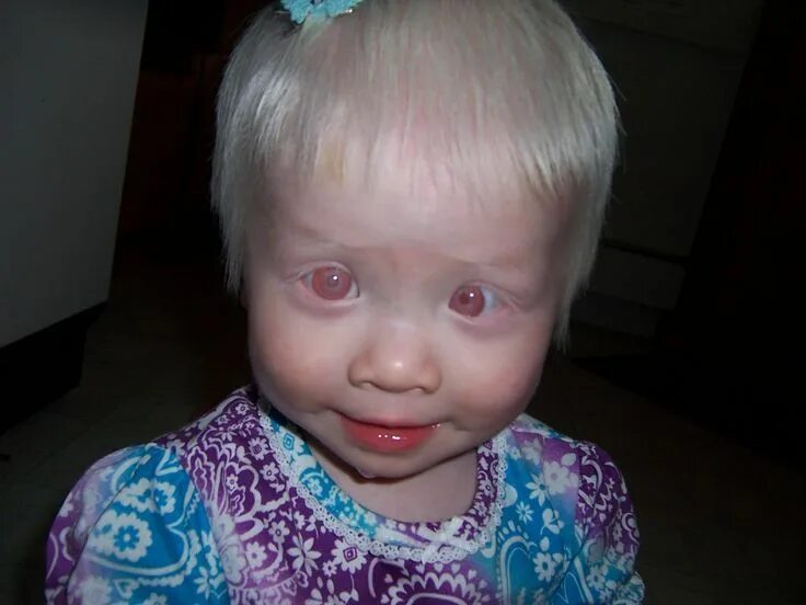 Красные глаза альбиносов фото Brazilian photographer Gustavo Lacerda wanted to give albino people the chance t