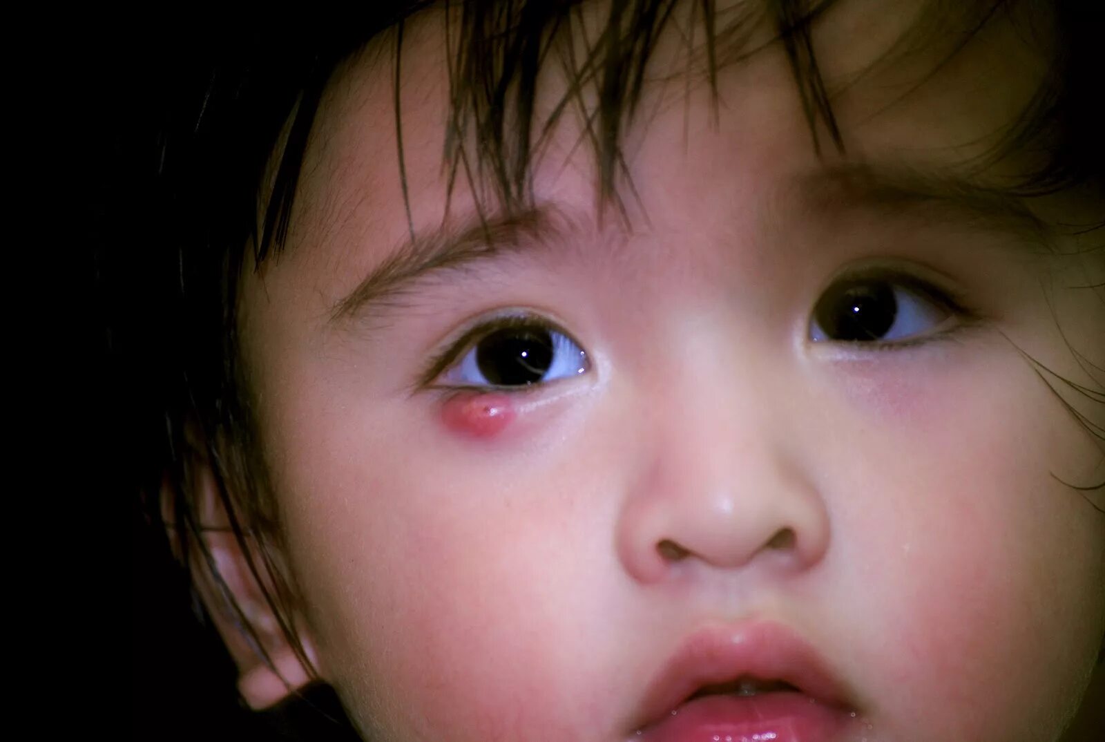 Красные глаза у детей фото Eye Infection Types, Symptoms & Treatments in Babies - New Kids Center