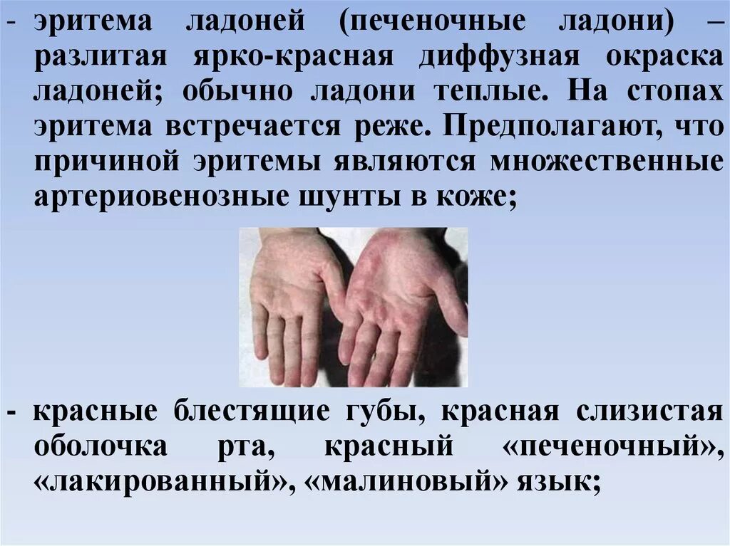 Красные ладони при болезни печени фото Битурия CoffMachines.ru
