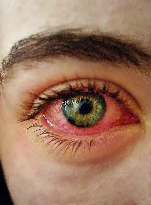 Красный глаз причины фото Wiz Khalifa - Look Into My Eyes Lyrics Genius Lyrics