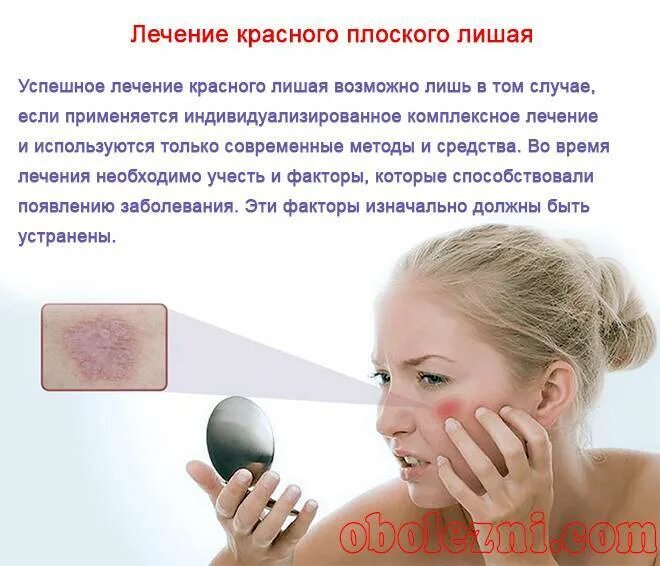 Красный лишай лечение фото Симптомы розового лишая у ребенка с фото, принципы лечения в домашних условиях