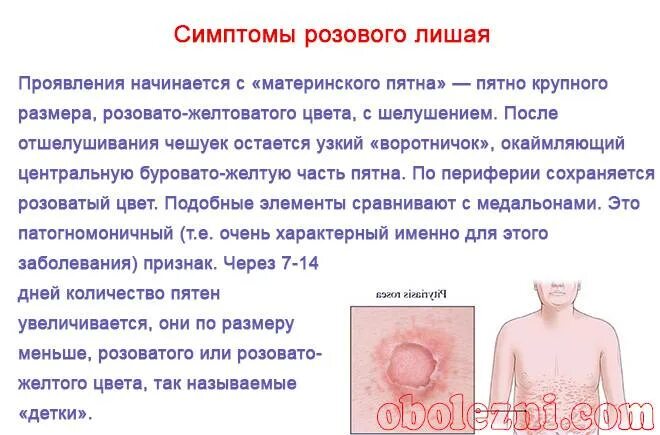 Красный лишай у человека фото как выглядит Стригущий лишай у детей: о формах и лечении рассказывает опытный педиатр