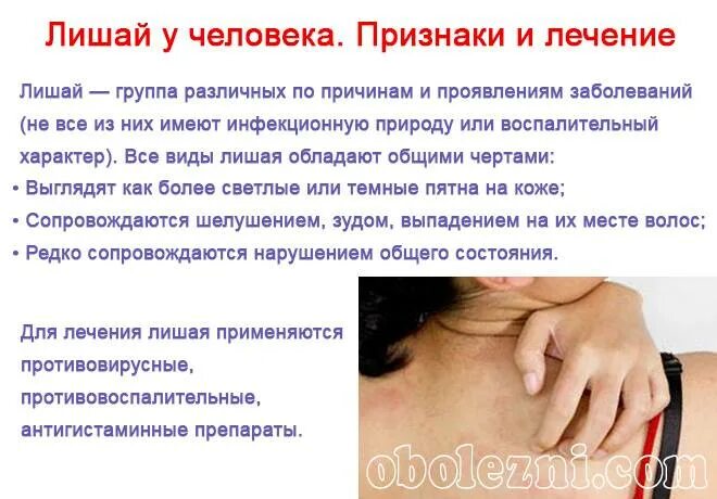 Красный опоясывающий лишай причины и лечение фото Стригущий лишай у детей: о формах и лечении рассказывает опытный педиатр