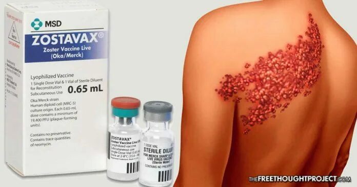 Красный опоясывающий лишай причины и лечение фото Vaccine failure: Merck being sued for shingles vaccine that causes the afflictio