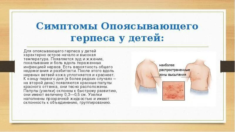Красный опоясывающий лишай причины и лечение фото Герпес у грудного ребенка: симптомы и лечение