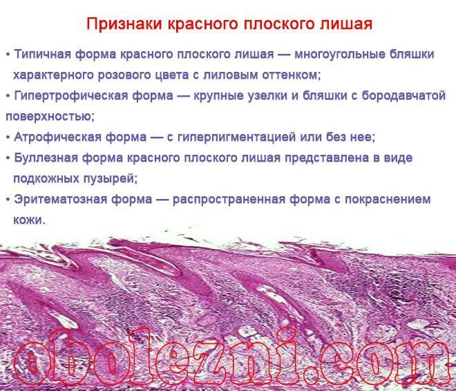 Красный плоский бородавчатый лишай фото Лишай красный плоский: причины, симптомы и лечение в статье детского дерматолога