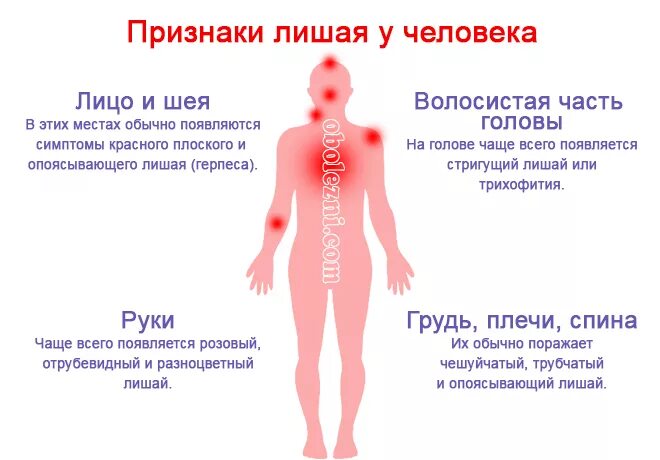 Красный плоский лишай фото на коже лечение Розовый лишай у собаки: симптомы и лечение причины