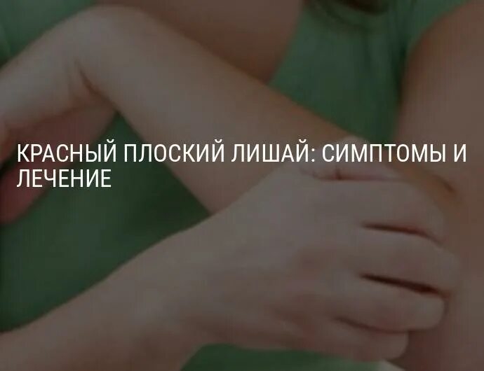Красный плоский лишай фото у взрослых Красный плоский лишай слизистой рта и кожи, симптомы и лечение