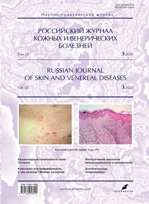 Красный плоский лишай на половых губах фото Vol 23, No 3 (2020) - Russian Journal of Skin and Venereal Diseases