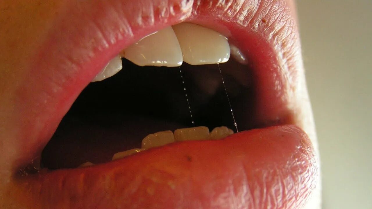 Красный плоский во рту фото Hunger Is Unconsciousness / How To Cure Disease - YouTube