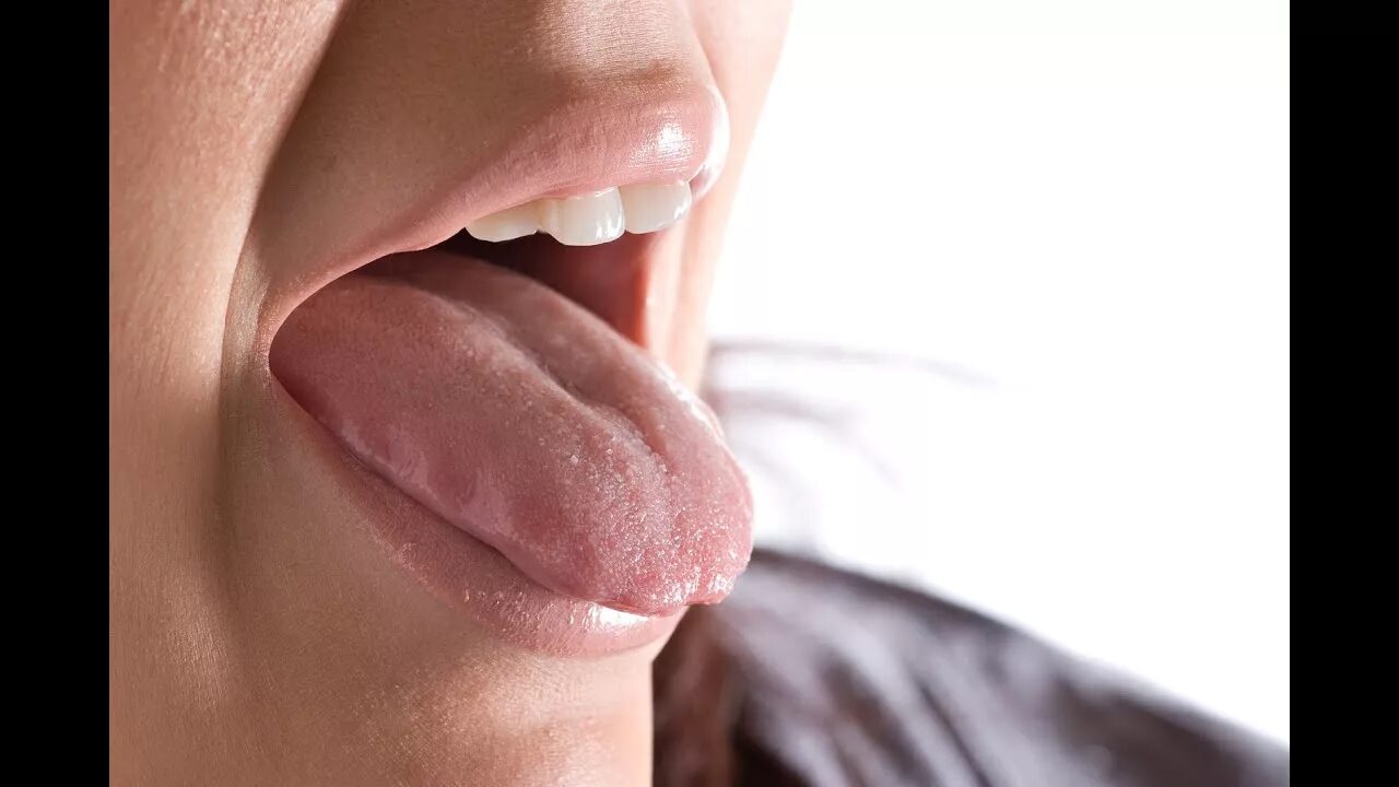 Красный плоский во рту фото Dentist Geelong: Handling Dry Mouth Problems - YouTube
