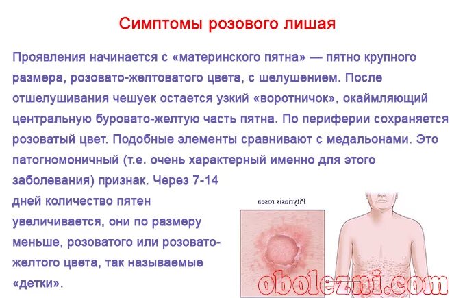 Красный розовый лишай фото Чем лечить лишай у ребёнка: 6 основных принципов терапии