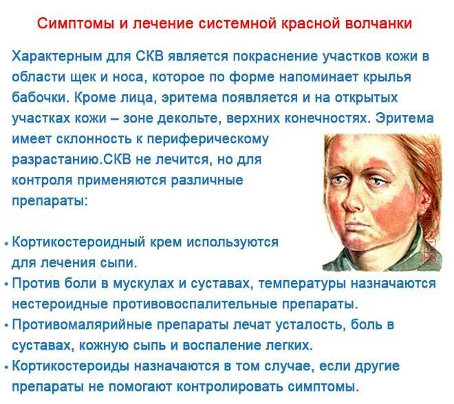 Красный волчанка болезнь симптомы фото Волчанка симптомы анализ лечение
