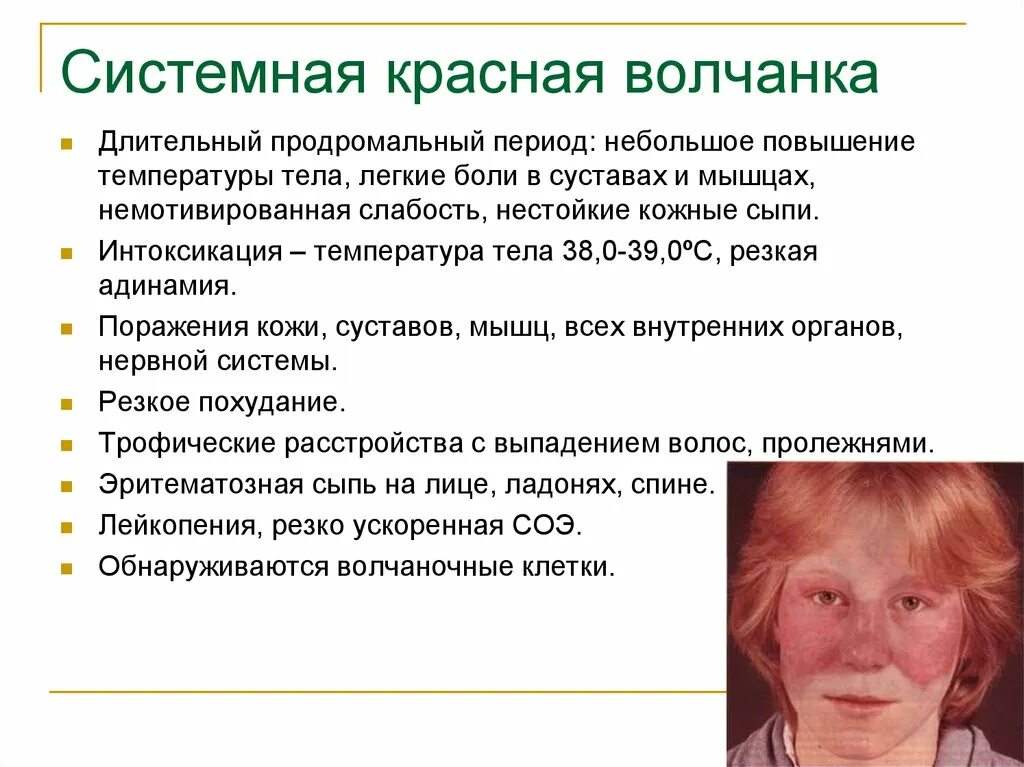 Красный волчанка болезнь симптомы фото Вощанка - CoffeePapa.ru