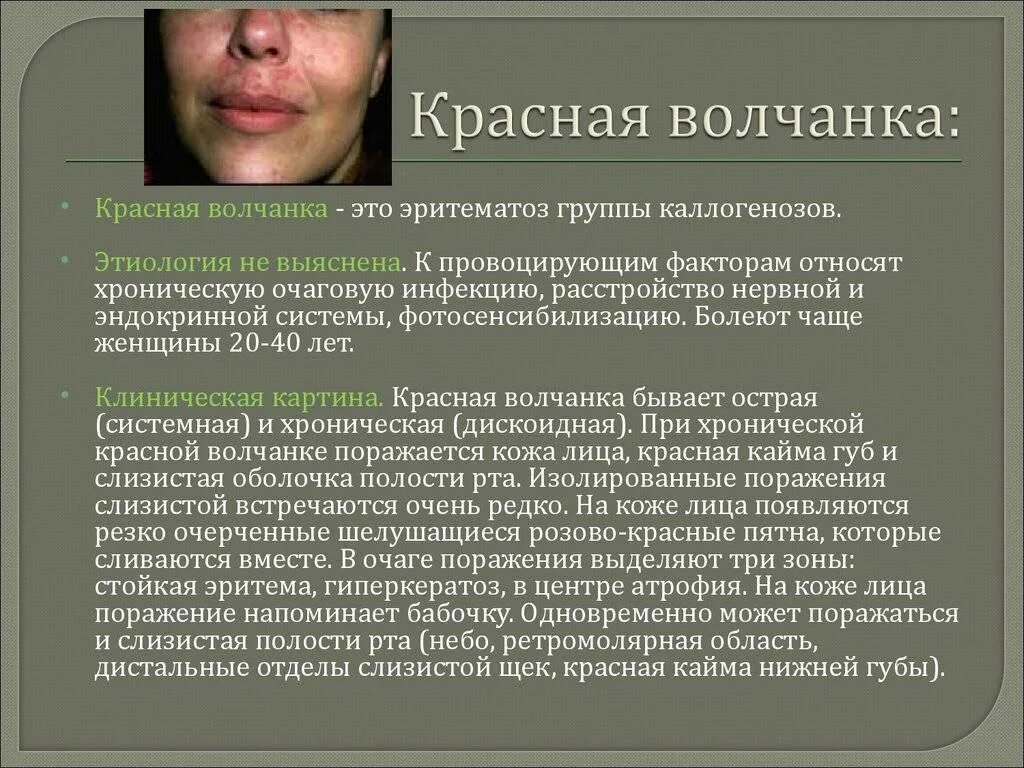 Красный волчанка болезнь симптомы фото Вощанка - CoffeePapa.ru