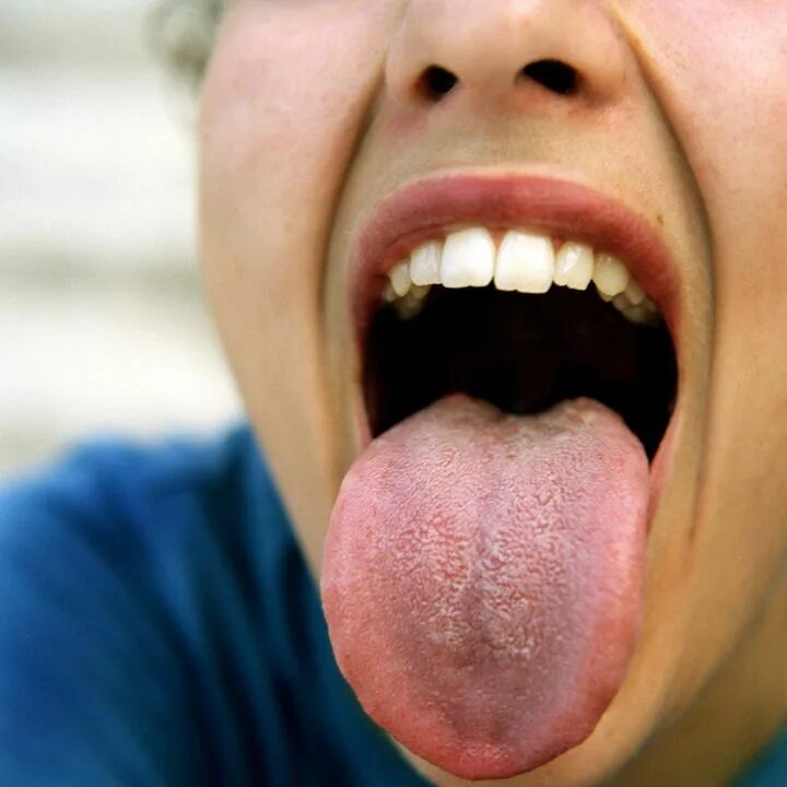 Красный язык фото Uni Is Gonads. Go Chew On That. HuffPost Life